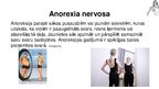 Prezentācija 'Anorexia nervosa (anoreksija), bulimia nervosa (bulīmija), kompulsīvā pārēšanās', 4.