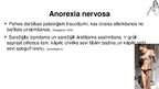 Prezentācija 'Anorexia nervosa (anoreksija), bulimia nervosa (bulīmija), kompulsīvā pārēšanās', 50.
