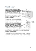 Konspekts 'Acne', 4.