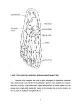 Referāts 'Plakanā pēda', 4.