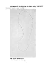 Referāts 'Plakanā pēda', 15.