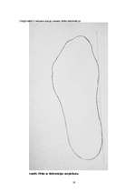 Referāts 'Plakanā pēda', 16.