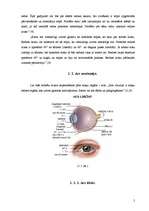 Referāts 'Acu krāsas ietekme uz redzi', 4.