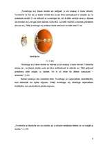 Referāts 'Acu krāsas ietekme uz redzi', 8.