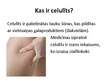 Prezentācija 'Celulīts', 2.