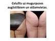 Prezentācija 'Celulīts', 8.