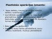 Prezentācija 'Plastiskās operācijas', 3.