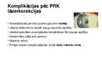 Prezentācija 'PRK jeb fotorefraktīvā keratometrija', 6.