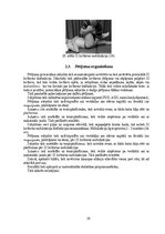 Diplomdarbs 'Sakroiliakālās locītavas mobilizācijas ietekme uz iegurņa funkcionālo stāvokli u', 29.