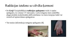 Prezentācija 'Vides piesārņojuma veidi un to ietekme uz cilvēku', 4.