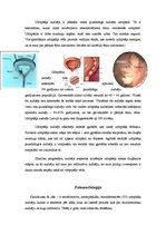 Referāts 'Urīnpūšļa audzējs', 3.