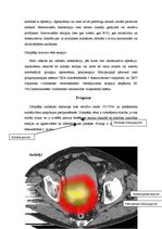 Referāts 'Urīnpūšļa audzējs', 7.