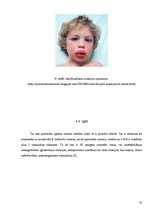 Konspekts 'Imūnglobulīni', 11.