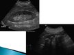 Prezentācija 'Nefropātiju radioloģiskās diagnostikas metodes', 8.