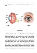 Referāts 'Jaunieši un brilles', 6.