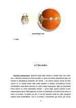 Referāts 'Jaunieši un brilles', 12.