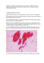 Konspekts 'Galvas smadzeņu hemorāģisks infarkts', 5.