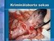 Prezentācija 'Aborta definīcija un abortu veidi', 5.