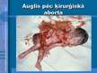 Prezentācija 'Aborta definīcija un abortu veidi', 6.