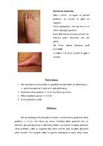 Konspekts 'Pēdas stāvokļa noteikšana', 3.