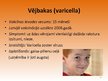 Prezentācija 'Bērnu infekcijas slimības', 16.