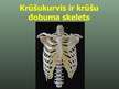 Prezentācija 'Balsta un kustību orgānu sistēma', 41.