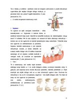 Referāts 'Zobu protezēšana', 12.