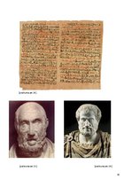 Referāts 'Zobu protezēšana', 30.