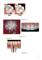 Referāts 'Zobu protezēšana', 35.