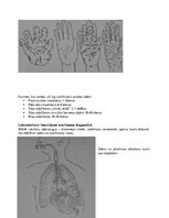 Konspekts 'Konspekts tiesu medicīnā', 52.