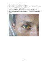 Konspekts 'Leptospiroze', 4.