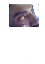 Konspekts 'Leptospiroze', 5.