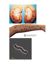 Konspekts 'Leptospiroze', 7.