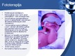 Prezentācija 'Jaundzimušo hemolītiskā slimība. Fototerapija', 10.