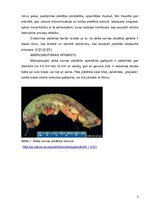 Referāts 'Hronisks apendicīts', 5.