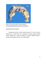 Referāts 'Hronisks apendicīts', 6.