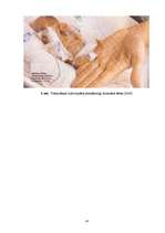 Referāts 'Jaundzimušo neiznēsātības cēloņi un priekšlaicīgi dzimušo bērnu aprūpe', 14.