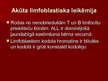 Prezentācija 'Akūta leikoze', 11.