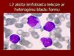 Prezentācija 'Akūta leikoze', 14.