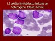 Prezentācija 'Akūta leikoze', 15.