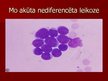 Prezentācija 'Akūta leikoze', 19.