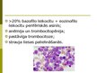 Prezentācija 'Hroniskas mieloleikozes raksturojums un laboratoriskā diagnostika', 10.