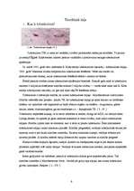 Referāts 'Tuberkulozes izplatība Latvijā', 6.