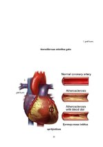 Referāts 'Stenokardijas riska faktori vīriešiem pēc piecdesmit gadiem', 31.
