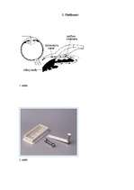 Referāts 'Glaukoma - lielākais akluma cēlonis pasaulē', 22.