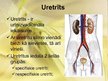 Prezentācija 'Urīnceļu infekcijas', 10.