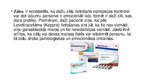 Prezentācija 'Epilepsija', 4.