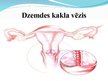 Prezentācija 'Dzemdes kakla vēzis', 5.