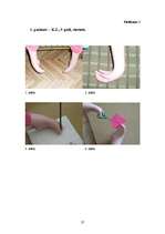 Referāts 'Artrogripozes klīniskās izpausmes, sekas, ārstēšana un rehabilitācijas iespējas', 37.