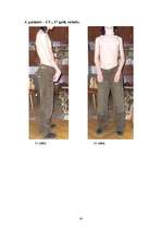 Referāts 'Artrogripozes klīniskās izpausmes, sekas, ārstēšana un rehabilitācijas iespējas', 40.